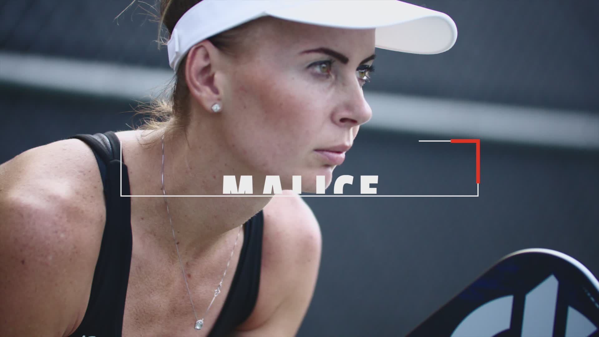 Onix Sports Malice Open Throat DB 14 mm Pickleball Paddle